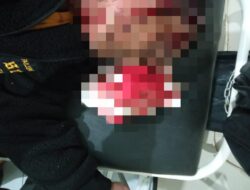 Salah Satu Wartawan Media Online Di Majalengka Menjadi Korban Pembacokan Oleh Orang Tidak Dikenal