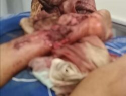 Perjuangan Firman Jaya Halawa: Terpinggirkan Tanpa Santunan setelah Kecelakaan Kerja Tragis di Kebun Sawit PT PHI