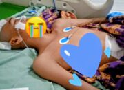 Anak Yatim Piatu Kaur Butuh Bantuan Biaya Operasi Tumor Otak Dan Hidrosefalus