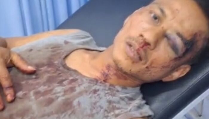Penyerangan di Afdeling 21 Batang Kumu II, 26 Pekerja Jadi Korban