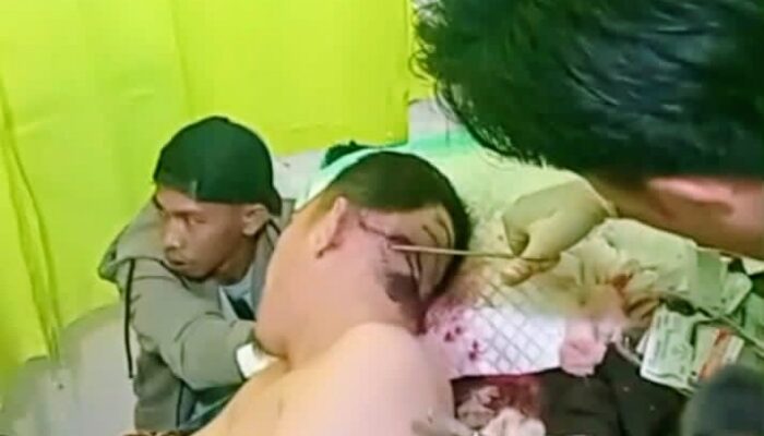 MENCEKAM! Pulang dari Masjid, Kades Pelajaran I Ditabrak Motor, Dikejar hingga Dibacok — Tiga Luka di Belakang Kepala